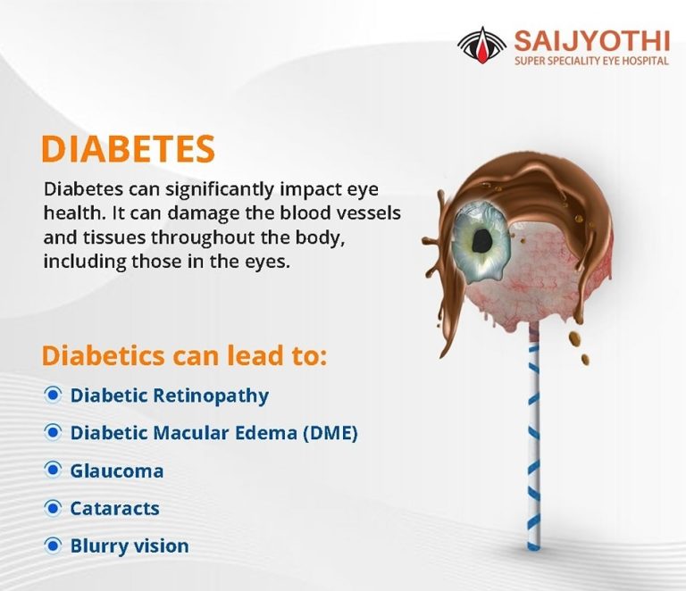 Diabetic Eye Doctor in Hyderabad