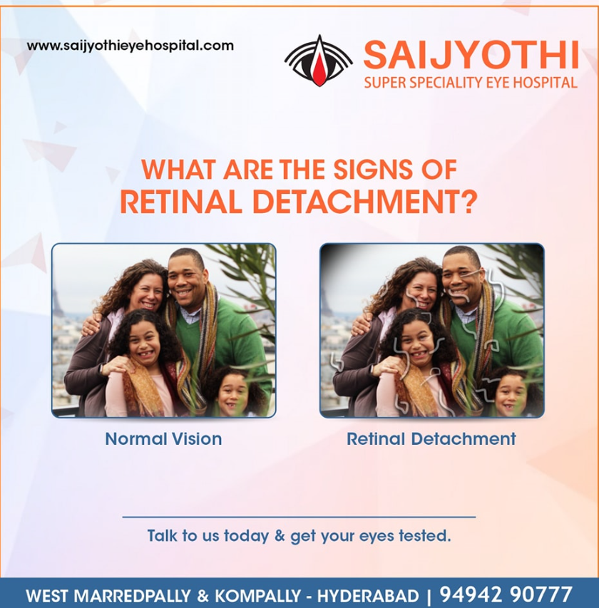 Retina Surgery in Hyderabad