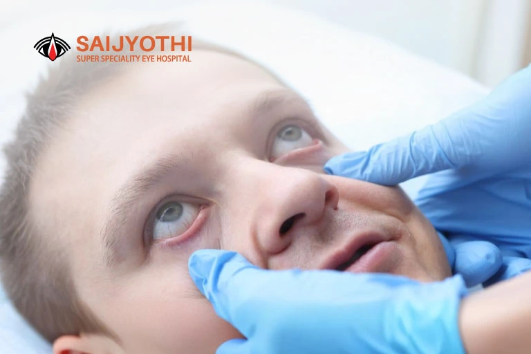 Things to Avoid After Cataract Surgery for Smooth Recovery