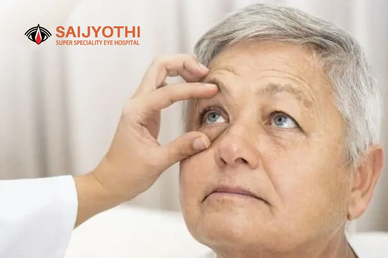 How To Manage Dry Eye After Cataract Surgery?