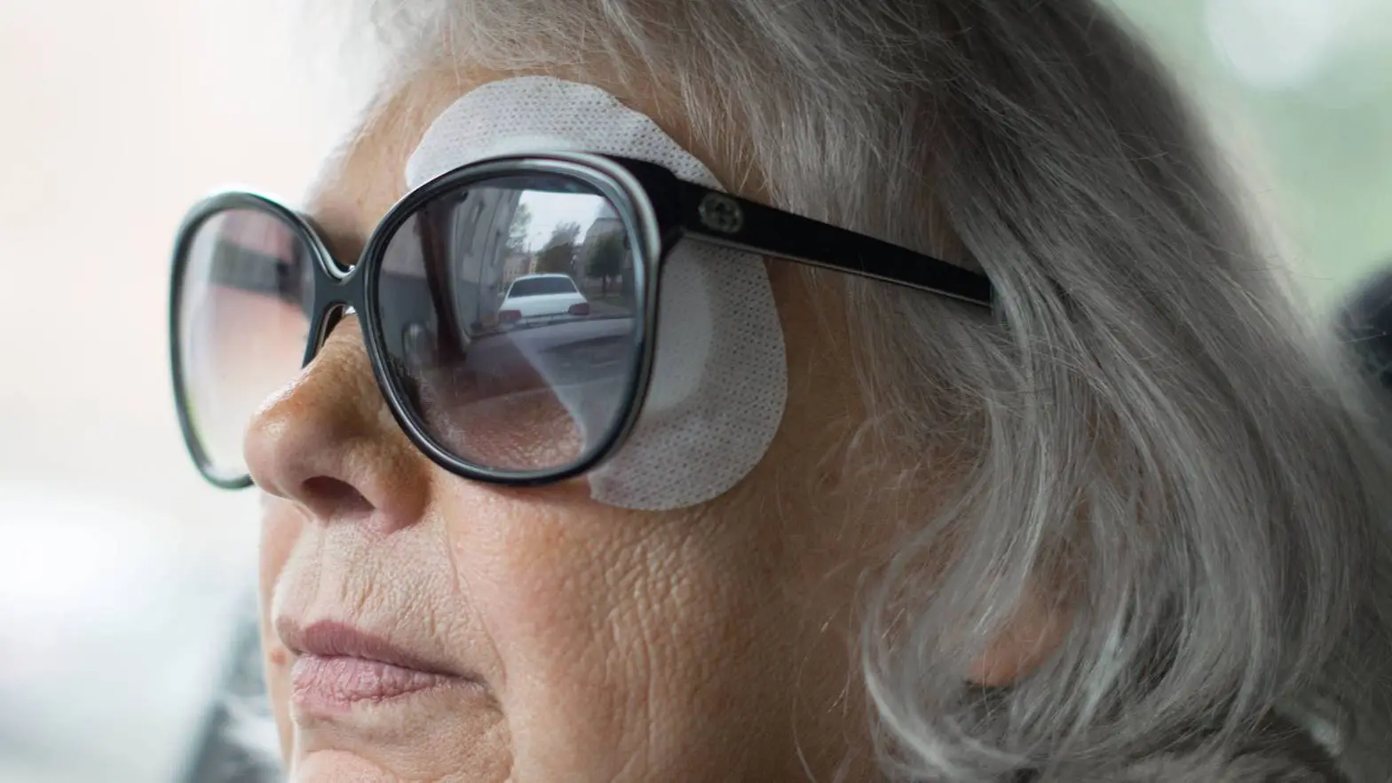 Eye Shield After Cataract Surgery